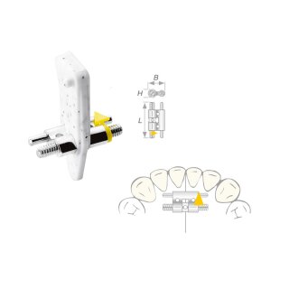 Dehnschraube Vector 080 medium 10St