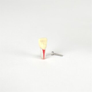 Modellzahn OK 21 Wuka m.Schr. St