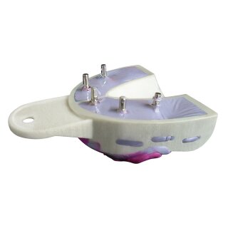 Miratray Implant UK I2 6St Set