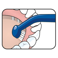 TePe Implant Care  14St