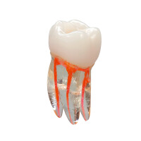 VDW Endo Übungszahn  St