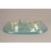 Studienmodell Demo Implant C+B St