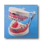 Brackets-Demo Modell OK+UK+Artik.St