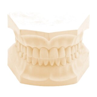 Glastone Superhartgips Tan   22,7Kg