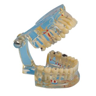 Studienmodell Transparent Plus St