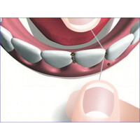 Mirafloss Zahnseide ungewachst 20m