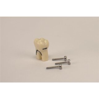 Modellzahn A-PB ZEC3 OK 26 St