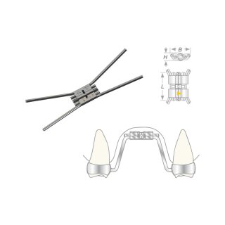 Vector 620 Gaumennahtschraube St