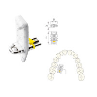 Vector 420 Sek.Dehnschraube Min10St