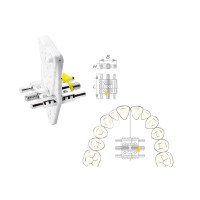 Dehnschraube Vector 200 maxi 50St