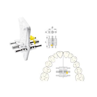 Dehnschraube Vector 200 maxi 10St