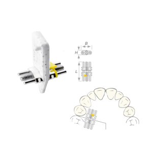 Dehnschraube Vector 140 medium 50St