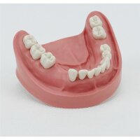 Endo-Z HM Bohrer 152 FG 25mm 5St