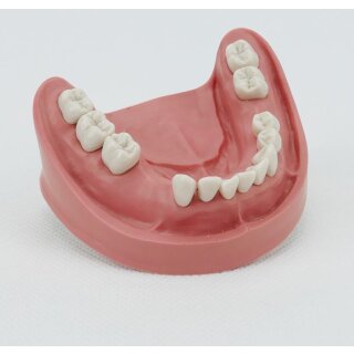 Zahnmodell UK TZ 13 St