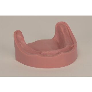 Studienmodell UK UB Gingiva  St