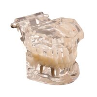 Studienmodell f. Zahnkrankheiten  St