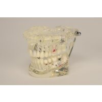 Studienmodell f. Zahnkrankheiten  St