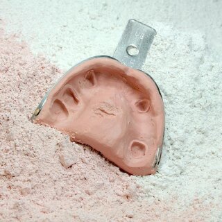 Abdruckgips Dr.Balzer