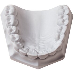 Orthodontic Stone