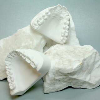 Alabastergips Universal & Spezial