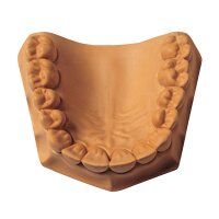 Resin Rock pfirsich Typ4 15Kg