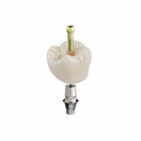 CEREC Tessera Abutment LT A3 A14 L 3St