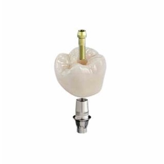 CEREC Tessera Abutment LT A3 A16 L 3St