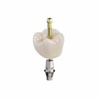 CEREC Tessera Abutment LT A3 A16 L 3St