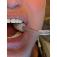 Comfi-Tips Absaugpolster f. Speichels,